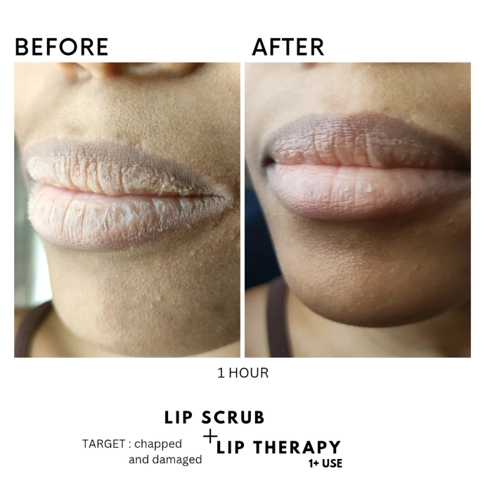 Dry lips review Dry and chapped lips recovery